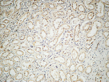 IL-2 Polyclonal Antibody