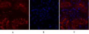 IGF-IR Polyclonal Antibody