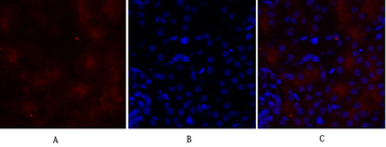 IGF-IR Polyclonal Antibody