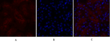 IGF-IR Polyclonal Antibody