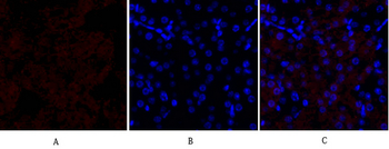 HSP27 Polyclonal Antibody