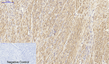 HSP27 Polyclonal Antibody