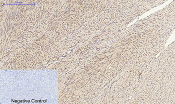HSP A5 Polyclonal Antibody