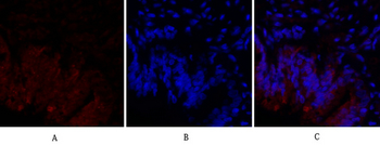 HIF-1α Polyclonal Antibody