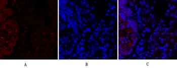 HIF-1α Polyclonal Antibody