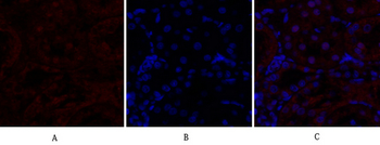 HIF-1α Polyclonal Antibody