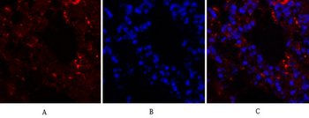 HIF-1α Polyclonal Antibody
