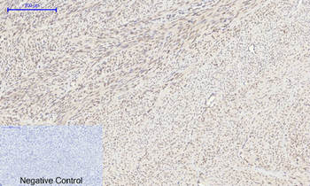 HIF-1α Polyclonal Antibody