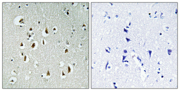 HEI10 Polyclonal Antibody