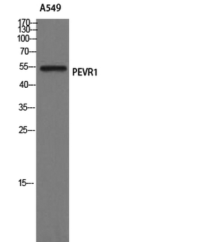 GPR172A Polyclonal Antibody