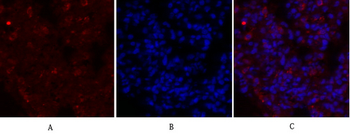 Glut1 Polyclonal Antibody
