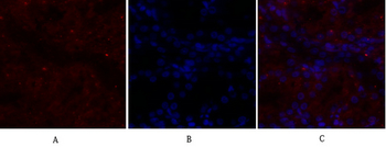 Glut1 Polyclonal Antibody
