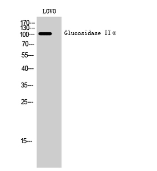 Glucosidase IIα Polyclonal Antibody