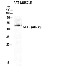 GFAP Polyclonal Antibody