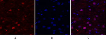 FAK Polyclonal Antibody