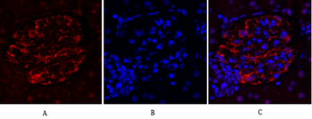 FAK Polyclonal Antibody