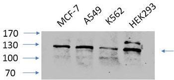 FAK Polyclonal Antibody
