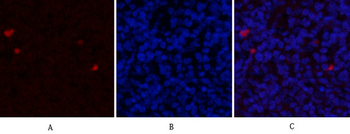 ERα Polyclonal Antibody