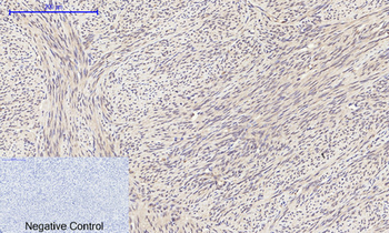 eIF2α Polyclonal Antibody