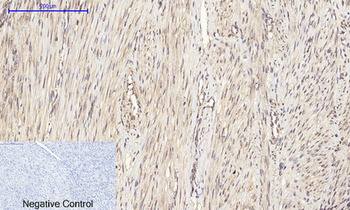 eIF2α Polyclonal Antibody