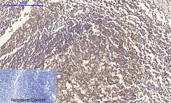 eIF2α Polyclonal Antibody