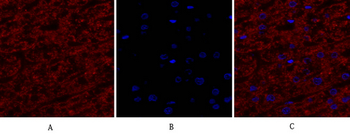 EGFR Polyclonal Antibody