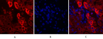 EGFR Polyclonal Antibody