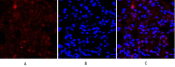E-cadherin Polyclonal Antibody