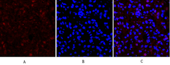 E-cadherin Polyclonal Antibody