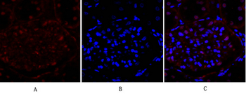 E-cadherin Polyclonal Antibody