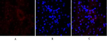 E-cadherin Polyclonal Antibody