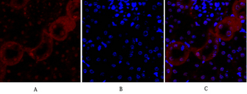 E-cadherin Polyclonal Antibody