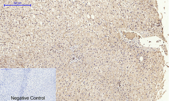 E-cadherin Polyclonal Antibody