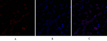 Dnmt3b Polyclonal Antibody
