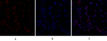 Dnmt3b Polyclonal Antibody