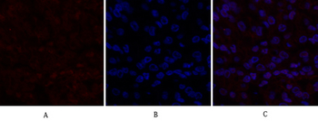 Dnmt3b Polyclonal Antibody