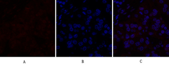 Dnmt3b Polyclonal Antibody