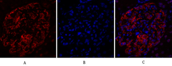 Dnmt3b Polyclonal Antibody