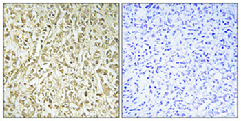 DNA pol λ Polyclonal Antibody
