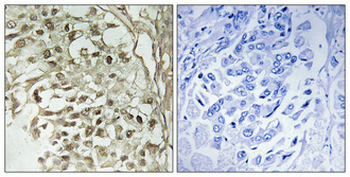 Dbf4 Polyclonal Antibody