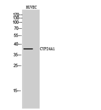 CYP24A1 Polyclonal Antibody
