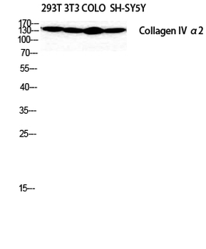 COL4A2 Polyclonal Antibody