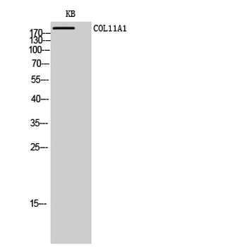 COL11A1 Polyclonal Antibody