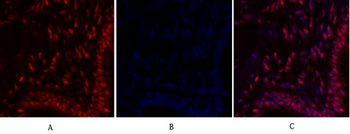 c-Myc Polyclonal Antibody