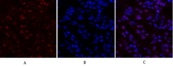 c-Myc Polyclonal Antibody