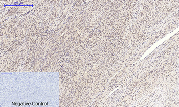 c-Myc Polyclonal Antibody
