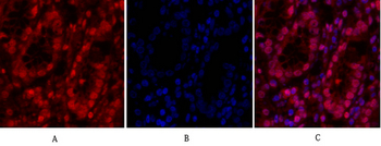 Cdk2 Polyclonal Antibody