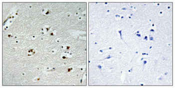 Cdc20 Polyclonal Antibody