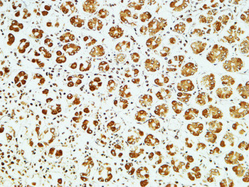CD83 Polyclonal Antibody