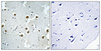 CAF-1 p60 Polyclonal Antibody